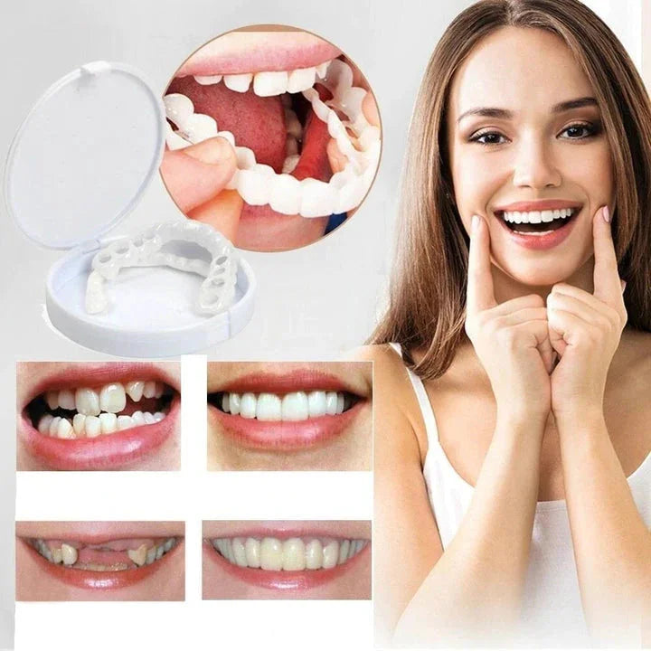 Snap-On Smile Veneers Customizable Instant Teeth Cover Natural Color Reusable Dental Appliance