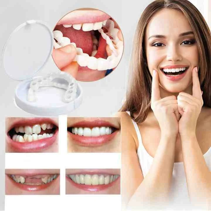 Snap-In Dental Prosthesis Snap-On Dentures Flexible Fit for Missing, Crooked, or Discolored Teeth
