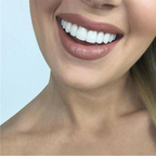 PerfectSnap Snap-On Veneers Reusable Plastic Teeth Cover Adjustable Fit for Instant White Smile
