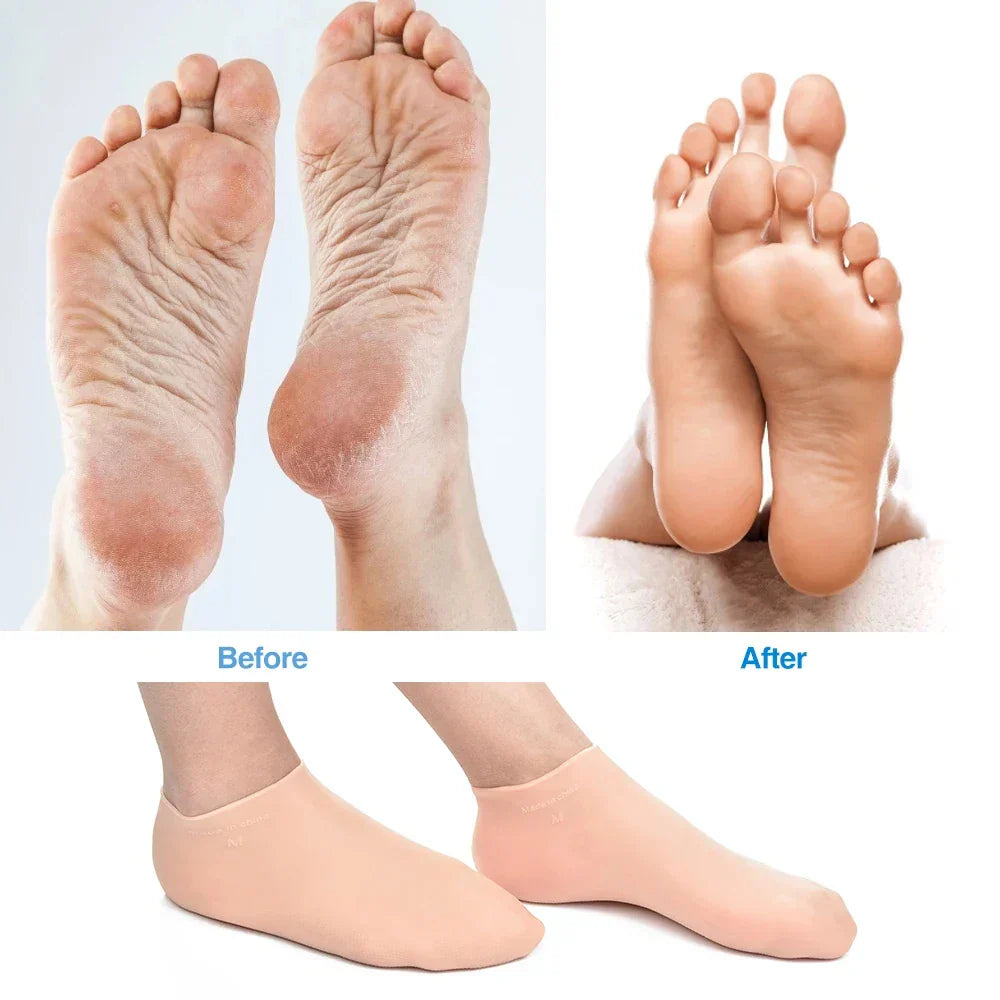 Silicone Wetsuit Beach Socks Non-Slip Water Shoes Quick-Dry Aqua Socks for Surfing Snorkeling Swimming