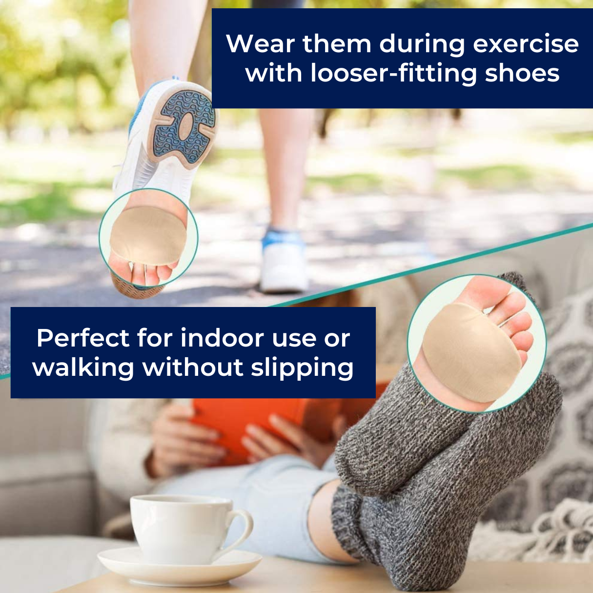 ComfortStep Gel Cushion Foot Pads for Morton’s Neuroma and Metatarsalgia Relief with Metatarsal Support