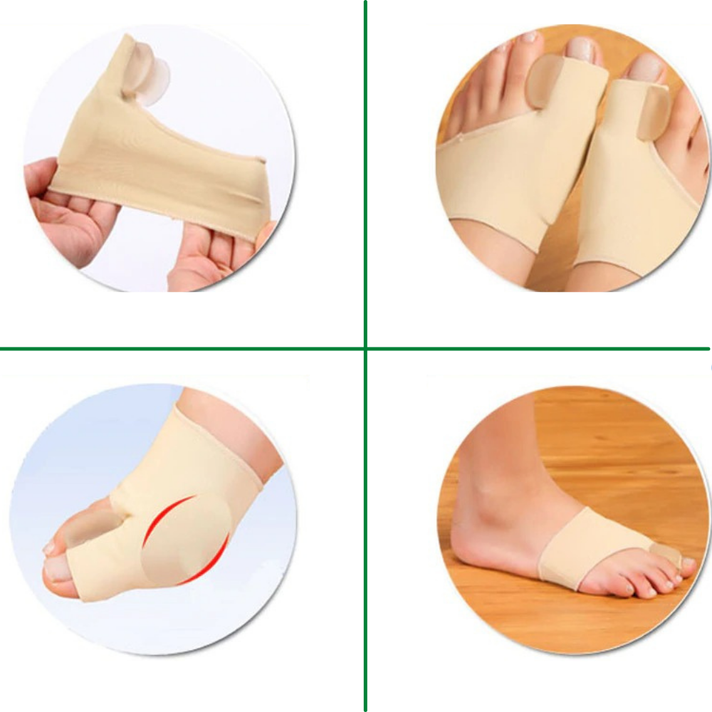 Orthotics for Hallux Valgus with Polymer Gel Pain Relief Sleeve for Toe Realignment and Bunion Correction