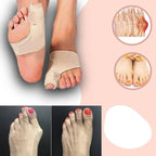 Orthotics for Hallux Valgus with Polymer Gel Pain Relief Sleeve for Toe Realignment and Bunion Correction