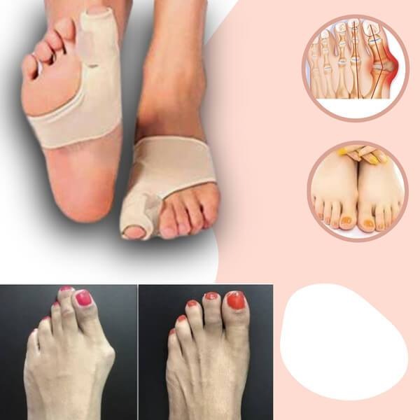 Orthotics for Hallux Valgus with Polymer Gel Pain Relief Sleeve for Toe Realignment and Bunion Correction