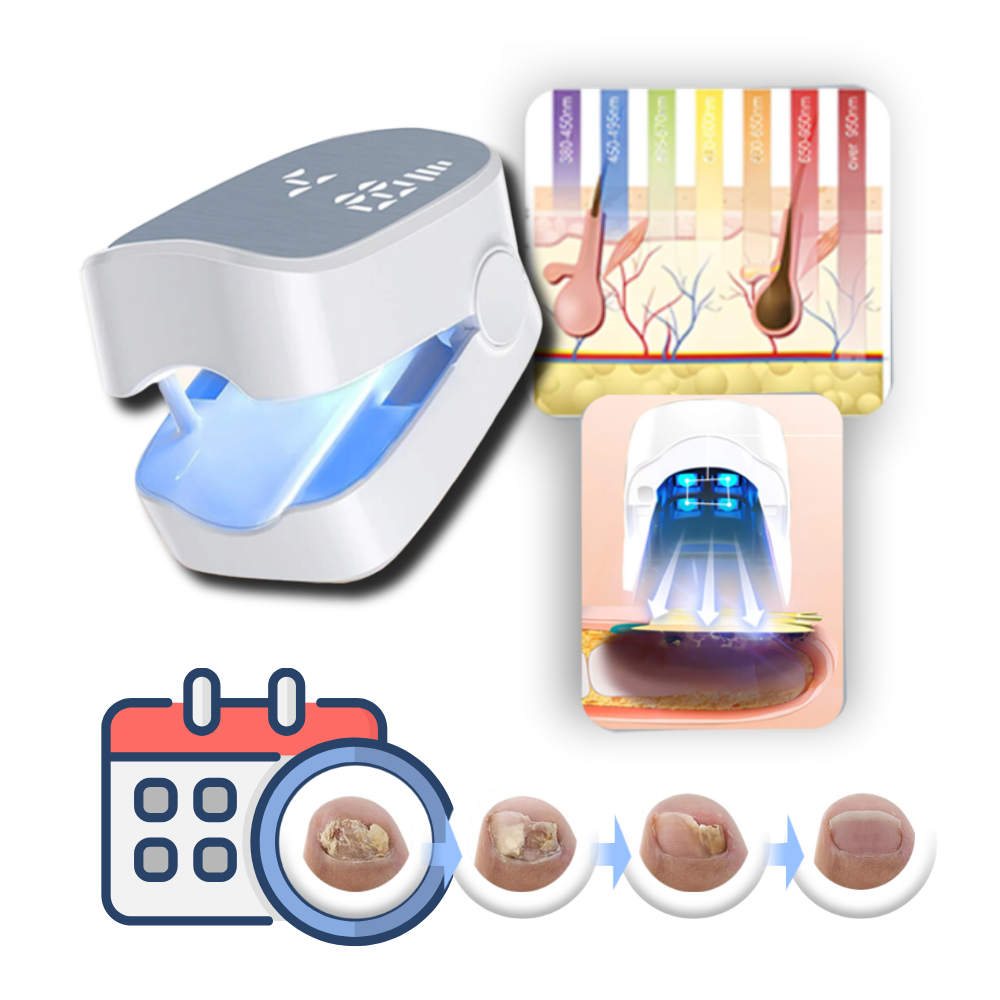 Laser Nail Fungus Treatment Device Dual Laser Technology Portable Handheld 7-Minute Sessions