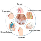 Orthopedic Toe Corrector Adjustable Hallux Valgus Hammer Toe Separator Soft Gel Foot Aligners