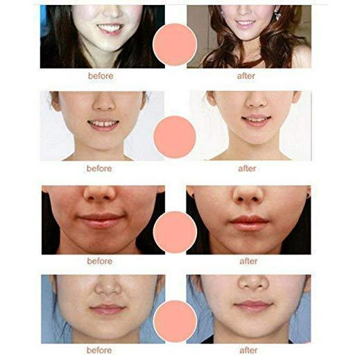 V Line Chin Up Face Lift Mask for Slimming, Toning, and Tightening Skin