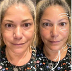 Unshakable Glow Instant Skin Brightening Serum for Radiant, Magnetic Confidence